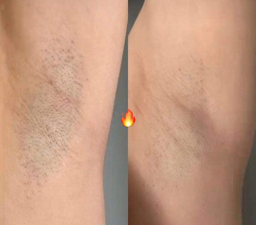 نتيجة قبل وبعد 3